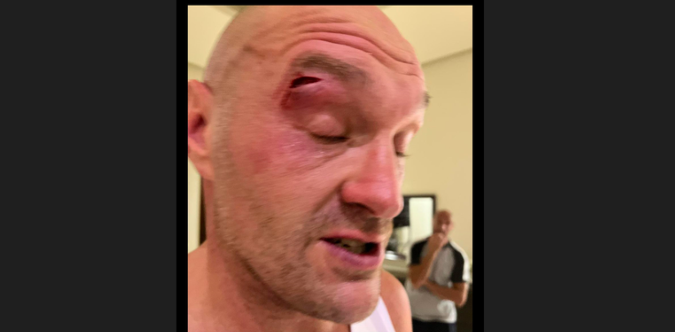 Frank Warren slams ‘scandalous’ criticism of Tyson Fury after Usyk fight postponed